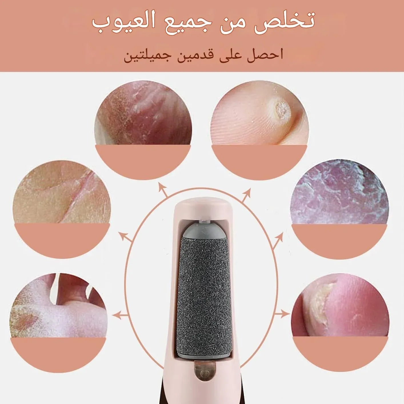 أقدام ناعمة في دقائق  جهاز كهربائي يزيل الجلد الميت والتشققات بسهولة وبدون ألم