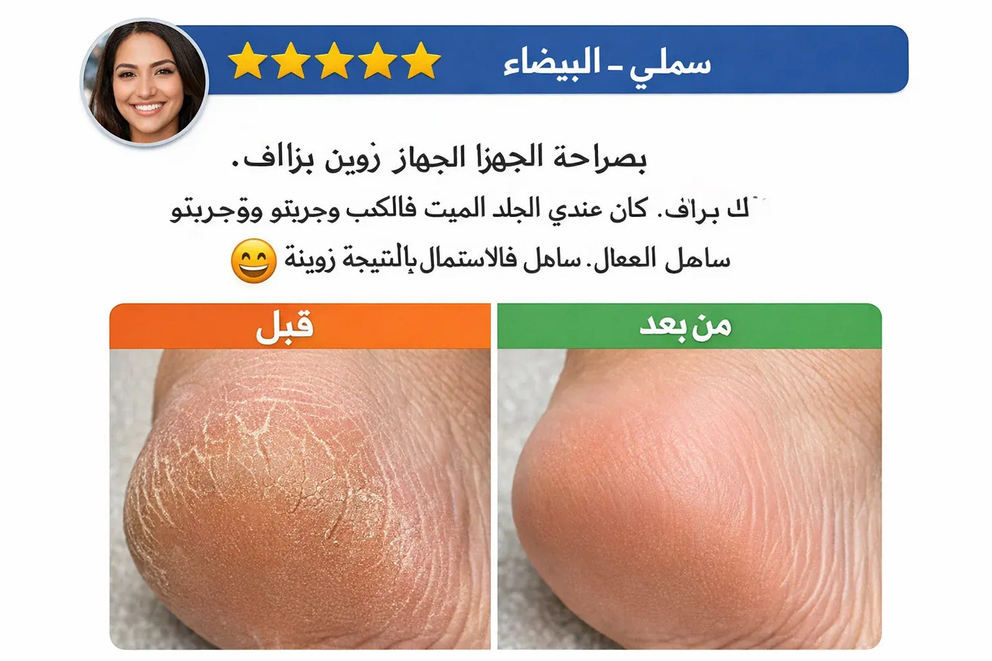 أقدام ناعمة في دقائق  جهاز كهربائي يزيل الجلد الميت والتشققات بسهولة وبدون ألم