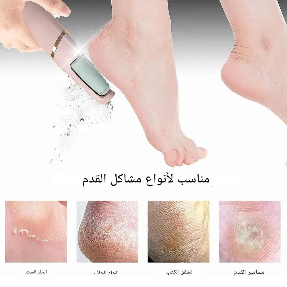 أقدام ناعمة في دقائق  جهاز كهربائي يزيل الجلد الميت والتشققات بسهولة وبدون ألم